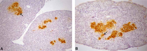 Figure 6. (A–B). Photomicrographs of glucagon-immunoreactive (IR) cells in the pancreas of Tropidurus torquatus. A, The glucagon-IR cells at the islet-like regions can be observed (arrow; 230×). B, Note the presence of glucagon-IR cells at the exocrine parenchyma (arrow) closed-type cells (500×).