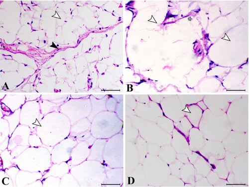 Figure 7. White adipose connective tissue sections of different groups. (A) control group (white arrowhead indicates normal fat cells and black arrowhead indicates normal fibrous septa), (B) adiposity group (white arrowheads indicate large fat cells with disrupted cell membrane), (C) bis-fused thiadiazinones 16 Group (arrowhead indicates decrease the size of the fat cells) and (D) bis-fused thiadiazinones 18 group (arrowhead indicates marked decrease the size of the fat cells). H&E stain, bar = 50 µm.