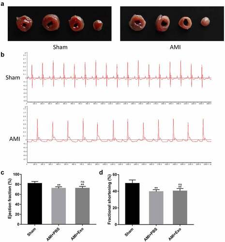 Figure 2. Establishment of a mouse AMI model. (a) Representative images of heart sections one day after LAD coronary artery ligation using TTC staining. (b) Electrocardiograms of mice were recorded using the BL-420 F biological signal acquisition and processing system. (c-d) One day after LAD coronary artery ligation, cardiac function-related parameters of the mice were assessed using transthoracic echocardiography (n = 6 per group). Statistical data were described as mean ± SD, ANOVA was used followed by LSD post hoc least significant difference test; **P < 0.01 vs. Sham group; ns meant no significance vs. AMI + PBS group. Abbreviations: AMI, acute myocardial infarction; PBS, phosphate-buffered saline; Exo, exosome; and ns, no significance.