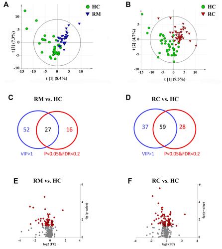 Figure 4 Profiling of metabolites from plasma samples of RMs and RCs as compared with HCs 3 months post discharge. Score plots of PLS-DA based on the 332 metabolites detected in the (A) RMs vs HCs and (B) RCs vs HCs. Venn diagram showing the number of differential metabolites in (C) RMs vs HCs and (D) RCs vs HCs. (E and F) Volcano plots of altered metabolites in RM, and RC patients as compared with HCs, the x-axis is the value of log2(FC), FC (fold change) represents the average level of metabolites in RMs or RCs relative to the average level in HCs, and the y-axis is -log (P value). The red dots represent the metabolites with two tailed P -value < 0.05.