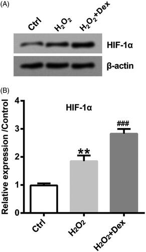 Figure 2. Dex induced the up-regulation of HIF-1α in PC12 cells. After pre-treatment by Dex (1 nM) for 30 min, cells were incubated by 50 µM H2O2 for 24 h. The level of HIF-1α protein was obtained by Western blot. **p < .01 vs. control (Ctrl) group. ###p < .001 vs. H2O2 group.