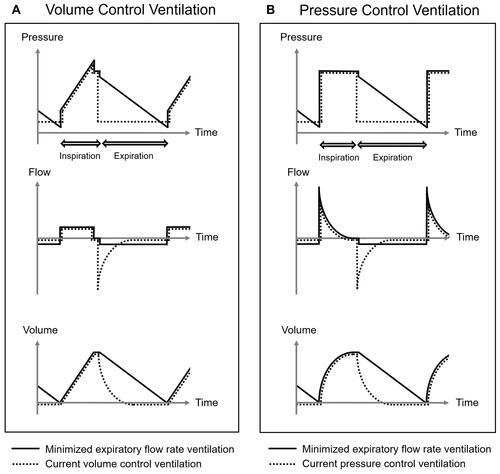 Figure 1 Minimized expiratory flow rate ventilation. The curves of pressure, flow, and volume during a respiratory cycle in the conceptual ventilation mode “minimized expiratory flow rate ventilation” are shown compared with those of current volume control ventilation (A) and pressure control ventilation (B).