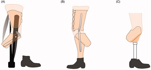 Figure 2. A shows a socket connected with a crutch; B shows a socket connected with a thigh corset, a shank, and foot by metal sidebars; C shows a transtibial socket connected with a shank and a foot.