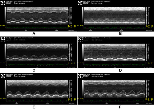 Figure 5 The noninvasive trans-thoracic echo images of different groups The echo images were taken by VEVO 3100, the most advanced equipment for small animal cardiac function detecting: (A), Sham group; (B), MI group; (C), Atorvastatin group; (D), HQ group; (E), DS group; and (F), HQ + DS group. Measurements of the left ventricle dimensions by M-mode tracing of the left ventricle are used for the calculation of LVEF, LVFS, LVEDd, and LVEDs.