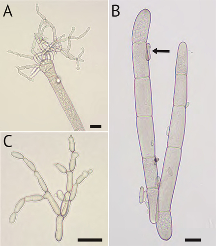 Figure 2. Microconidia of B. gigantea taken from plug-inoculated hemp leaves. A. Microconidia developing at the tip of a macroconidium. B. Size comparisons of microconidium (arrow) to macroconidium. C. Chains of microconidia with septa and visible branching pattern. Bars = 20 µm.