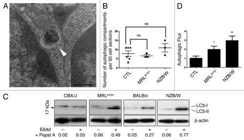 Figure 1. Increased autophagic flux in thymocytes from lupus-prone mice compared with controls (A) A representative autophagosome is indicated by the white arrow (black scale bar: 500 nm). (B) Quantification by TEM of autophagic vacuoles for 50 thymocyte sections randomly selected on thymus sections from 8 week-old CBA/J (open circles) and 12 week-old BALB/c (filled circles) control mice (CTL) and lupus-prone mice MRLlpr/lpr (8 week-old) and NZB/W (12 week-old). Each point represents measurement for an individual mouse. Central bars refer to the mean and vertical bars stand for standard deviation. ns = non-significant using unpaired t-test. (C) LC3 conversion assessed by western immunoblotting. Dissociated thymocytes obtained from 8 week-old control CBA/J and lupus MRLlpr/lpr mice or from 12 week-old control BALB/c and lupus NZB/W mice were cultured at 37°C for 16h. When indicated, cells were treated (+) or not (-) during the last 4 h of the culture with 5 µg/mL pepstatin A and 5 µg/mL E64d to block lysosomal degradation. Cell lysates were resolved by SDS-PAGE, transferred onto PVDF membranes before staining with anti-LC3 Ab. Loading controls were performed by staining actin β-chain. Each immunoblot is representative of three experiments with identical results. LC3-II/β-actin band intensity ratios are indicated as numbers under each immunoblot. (D) LC3-II levels were evaluated by densitometry and normalized to β-actin band intensities for at least three other independent experiments (right panel). Autophagic flux measurement consists on a ratio between the values with and without protease inhibitors (= autophagic flux). Histogram bars represent the means of individual experiments with standard errors. *p < 0.05 and **p < 0.01 using unpaired t-test between control and lupus conditions.