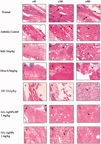 Figure 6. Microphotograph of rat ankle tissue at magnification 40×, 100× and 400×. Normal control (Row I) panel b represents sclerotic bone with arrow head indicating osteocytes. While in panel c, normal soft tissue arrow on both sides indicate muscles arrow head indicating blood vessels. In (row II) panel b of control tissue arrow head indicating granuloma composed of epithelioid macrophages, arrow on both side indicating fibro collagenous tissue, inflamed by mixed acute and chronic inflammatory cells and line shows thick and congested blood vessels along with granulation tissue. At places granuloma with epithelioid macrophages are seen in panel c. Indo 5 mg/kg (row III) panel b shows moderate inflammation while in panel c arrow head indicate thick and congested blood vessels along with granulation tissue. Dexa 0.5 mg/kg (row IV) panel b shows moderate inflammation while in panel c arrow head indicate thick and congested blood vessels along with granulation tissue. HP 25 mg/kg treatment (row V) shows moderate inflammation underline tissue exhibited granulomatous inflammation along with moderate chronic infiltrates and congested dilation blood vessels. Bony trabeculae identified surrounded by moderate chronic infiltrates and no pannus and cartilage damage seen.GA-AgNPs-HP1 mg/kg treatment (row VI) shows mild inflammation, arrow head indicating moderate cell infiltration. Nano-carriers GA-AgNPs 1 mg/kg (row VII) exhibited severe inflammation and increased of cell infiltration.