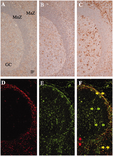 Figure 2. The expression of collagen modifying enzymes in non-neoplastic lymphoid tissues. The expression of prolyl 4-hydroxylase 1 (A), lysyl hydroxylase 3 (B), and protein disulfide isomerase (C) was more frequently observed in the marginal zone (MaZ) and germinal center (GC) than in the mantle zone (MnZ) or interfollicular area (IF). A, B, and C are serial sections of the tonsil. Transglutaminase II (D and F; rhodamine, red arrows) was predominantly expressed in the marginal zone and T-cell area, as was lysyl hydroxylase 3 (E and F; FITC, green arrows) as well as in the germinal center in a lymph node. Double positive cells of transglutaminase II and lysyl hydroxylase 3 were localized in the marginal zone and T-cell area (F; merged, yellow arrows).