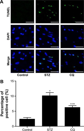 Figure 7 Effects of CQ on cardiomyocyte apoptosis in STZ-induced mice.