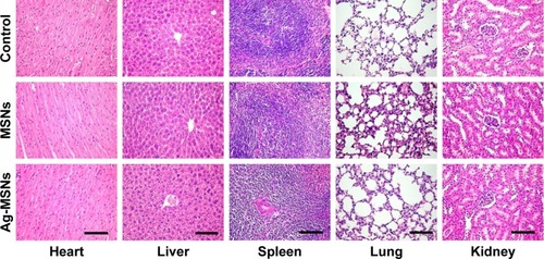 Figure 7 H&E staining images of the heart, liver, spleen, lung and kidney of rats from each group.Note: The scale bars represent 100 µm.Abbreviations: Ag-MSNs, nanosilver-decorated mesoporous silica nanoparticles; MSNs, mesoporous silica nanoparticles.