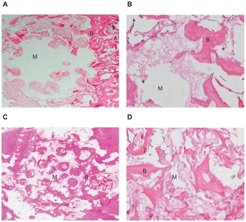 Figure 9 Hematoxylin and eosin stained section of mesoporous bioactive glass and polyamide composite scaffolds implanted into bone defects of rabbit femora for (A and B) 4 weeks (×5 and ×20, respectively) and (C and D) 12 weeks (×5 and ×20, respectively).Notes: B represents the new bone tissue, M represents the biomaterials.