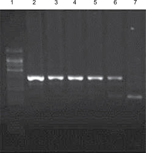 Figure 1 Determination of genotypes for VDR–ApaI polymorphism by using PCR-RFLP method.