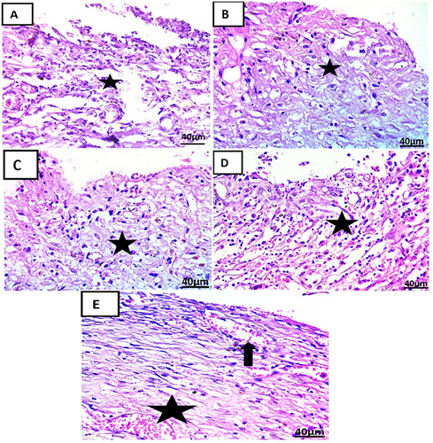 Figure 13 Photomicrographs of skin sections treatment at 7th day in each group (H & E x 400): (A) showing ill-organized fibrous connective tissue with infiltration by mononuclear inflammatory cells (Star). (B) showing fibrous connective tissue with infiltration by mononuclear inflammatory cells(star). (C) showing fibrous connective tissue formation with infiltration by mononuclear inflammatory cells (star). (D) showing fibrous connective tissue formation with mononuclear inflammatory cells and hemorrhage (star). (E) showing well-organized fibrous connective tissue with infiltration by mononuclear inflammatory cells (star) and formation of newly formed blood vessels (arrow).