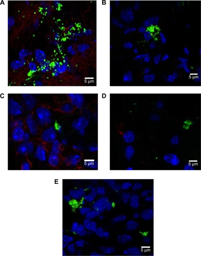 Figure 8 Rhodamine 6G/silica particles in mouse tissue.Notes: Confocal microscopy of frozen tissue sections is shown: (A) stomach, (B) kidney, (C) lung, (D) brain, and (E) spleen. Mice were administered optimized Rhodamine 6G/silica particles orally every 24 hours for 4 days, and organs were harvested 3 hours after the final administration. Sections were stained with 4′,6′-diamidino-2-phenylindole (cell nuclei; blue) and E-cadherin (junctions between epithelial cells; red). Brain tissue (D) was stained with GFAP (expressed by many cells of the central nervous system; red) instead of E-cadherin. Rhodamine 6G/silica particles are green.