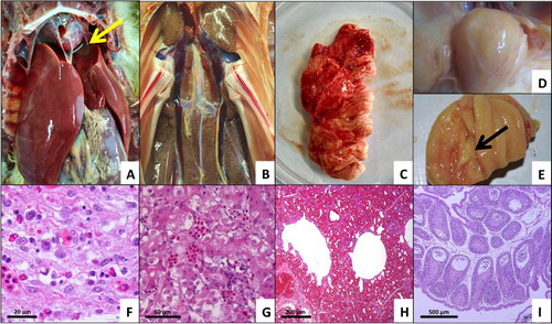 Figure 1. Gross lesions and histopathology in tissues from dead ducks. (A) Severe hydropericardium with a fluid volume ranging from 5 to 10 ml, enlarged discoloured liver, and point-like necrosis in the liver (arrow). (B) Multifocal areas of necrosis and petechial haemorrhage in kidneys. (C) Fibrinous and foam-like exudates around the lung tissue. (D&E) Caseous inflammatory exudates filling the bursa (arrow). (F) Typical virus inclusion bodies in liver cells (H&E stain). (G) Degeneration of partial renal tubular epithelial cells and congestion in kidneys (H&E stain). (H) Congestion in lungs (H&E stain). (I) Lymphocyte reduction, follicular atrophy, and vacuole formation in some of the follicles of the bursa (H&E stain).