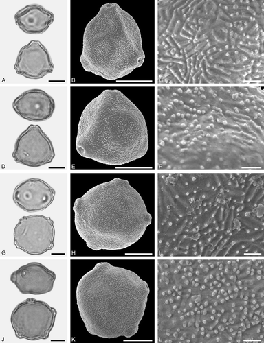 Figure 4. LM (A, D, G, J) and SEM (B, C, E, F, H, I, K, L) micrographs of dispersed fossil Betulaceae pollen. A–C. Betula sp. 1, close-up of polar area. D–F. Betula sp. 2, close-up of polar area. G–I. Carpinus sp. 1, close-up of polar area. J–L. Carpinus sp. 2, close-up of polar area. Scale bars – 10 µm (A, B, D, E, G, H, J, K), 1 µm (C, F, I, L).