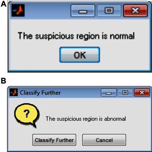 Figure 8 First-stage of classification: (A) normal mammogram classification; (B) abnormal mammogram classification.
