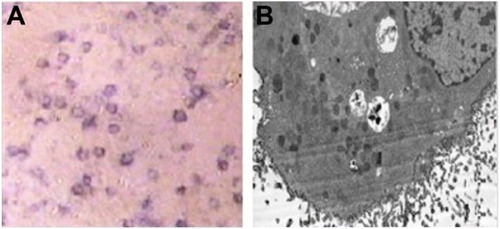 Figure 2 Alkaline phosphatase (AKP) assay and electronic microscopic examination of the type II alveolar epithelial cells (AEC II).