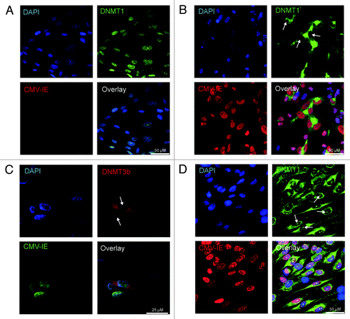 Figure 4. Intracellular localization of DNMT1 and DNMT3b in fibroblasts infected by VR1814 at 3dpi. DNMT1 in uninfected cells (A), DNMT1 in infected cells (B), DNMT3b in infected cells (C), DNMT1 in Foscavir treated virus infected cells (D). In (A, B and D), HCMV-IE proteins were visualized by Texas red conjugated donkey anti mouse IgG (red) and DNMT1 with Alexa488 conjugated donkey anti rabbit IgG (green). In C, HCMV-IE proteins were visualized with Alexa488-conjugated donkey anti mouse IgG (green) and DNMT3b were visualized by Texas red conjugated donkey anti rabbit IgG (red). Representative images of cells with nuclear depletion and cytoplasmic localization of DNMT1 and DNMT3b are marked by arrows. Note that the size bar in A, B and D is 50 µm, while the size bar in C is 25 µm.