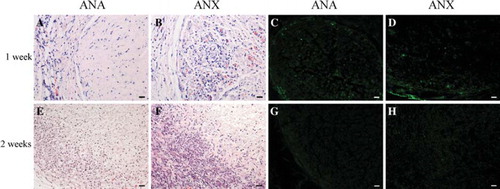 Figure 2. Immunological reaction elicited by ANA or ANX following subcutaneous implantation. H&E staining at 1 and 2 weeks post-implantation (A, B, E, and F). Immunostaining showed that a minority of CD3-positive T lymphocytes infiltrated in the grafts and host tissues after 1 week (C, D), and CD3 expression of the infiltrated T lymphocytes were reduced markedly after 2 weeks (G, H). Scale bar = 20 μm.