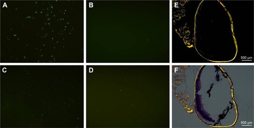 Figure 3 Chemotaxis of the GFP-labeled CR2-sFlt 1 toward complement cleavage fragments in the transwell assay (A–D) and mouse CNV model (E and F).