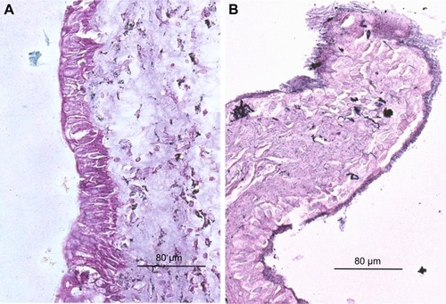 Figure 5 Representative urothelial regions in bladders of mice that received AuNP injection. (A) BBN-treated, gold enhanced, 40×; (B) non-BBN-treated, gold enhanced, 40×.Abbreviations: AuNP, gold nanoparticle; BBN, N-butyl-N-(4-hydroxybutyl)nitrosamine.