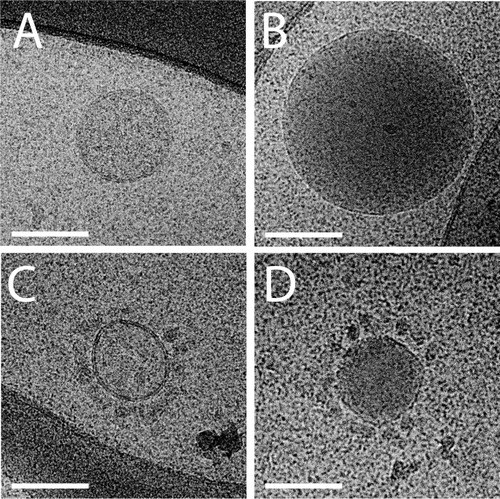 Fig. 2 Cryo-EM images of EV in platelet-poor plasma.In PPP, some large electron lucent vesicles with a clearly discernible lipid bilayer are present (A and C). Other particles are electron dense with a clear lipid bilayer (B and D). Some vesicles are surrounded by smaller spherical structures (C and D). Scale bars are 100 nm.