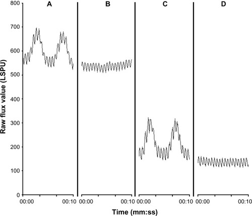 Figure 2 LSCI measurements for one patient.