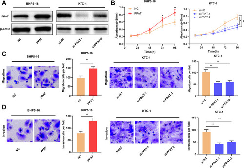 Figure 2 PPAT promoted TC cell proliferation, migration and invasion. (A) Western blot was used to detect the expression of PPAT protein in TC cells after overexpression or knockdown of PPAT. (B) CCK-8 method was used to detect the proliferation of BHP5-16 and KTC-1 cells. (C and D) Transwell assay was used to detect the migration and invasion of BHP5-16 and KTC-1 cells. The experimental results were analyzed by Student’s t-test, and the difference was statistically significant with P < 0.05. *P < 0.05 and **P < 0.01.