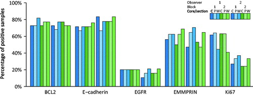Figure 1. Frequency of positive tumors for markers BCL2, E-cadherin, EGFR, EMMPRIN, and Ki-67. Immunohistochemical analyzes of markers were interpreted from TMA cores, one central (C) and one peripheral (P), and whole slide sections (W) each from two blocks (1 and 2) from each tumor. All cases have been scored by two observers, 1 and 2, respectively. Only tumors that were interpretable on all cores and sections were included in the analysis.