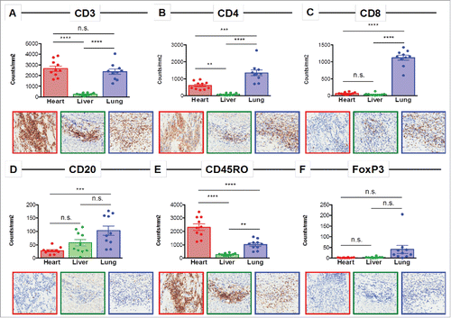 Figure 2. Immune profiling of the inflamed heart reveals a CD4-dominated T cell infiltrate. Representative immunohistochemistry images and quantification of 10 regions for (A) CD3, (B) CD4, (C) CD8, (D) CD20, (E) CD45RO, and (F) FoxP3 in the heart, liver, and lung. n.s. = not significant; ** = p < 0.01; *** = p < 0.001; **** = p < 0.0001.