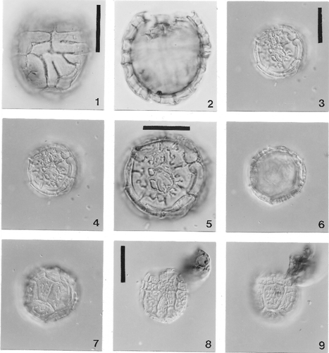 Plate 6. Light photomicrographs of two undescribed species of Histiocysta, taken using Nomarski interference contrast. 1, 2. Histiocysta sp. B; scale bar = 20 µm. Two focus levels of specimen in right lateral view. Compare with scanning electron photomicrographs of the same species in Plate 7, figures 1–5. Figure 1, right lateral focus (note accessory ridges within plates); figure 2, optical section. Navesink Formation, Maastrichtian, Atlantic Highlands, New Jersey. 3–7. Histiocysta sp. C; focus series through specimen in apical view; scale bars: figures 3, 4, 6, 7 = 25 µm, figure 5 = 20 µm. Figure 3, apical focus; figure 4, somewhat lower focus level of apical surface; figure 5, detail of figure 4; figure 6, optical section; figure 7, antapical focus. Note accessory ridges, somewhat more complex than those on specimen in figures. 1, 2. Rupel Clay, Rupelian (Early Oligocene), Boom, Belgium. 8, 9. Histiocysta sp. C; scale bar = 25 µm. Ventral (figure 8) and dorsal (figure 9) focus levels of specimen in ventral view. Rupel Clay, Rupelian (Early Oligocene), Boom, Belgium.