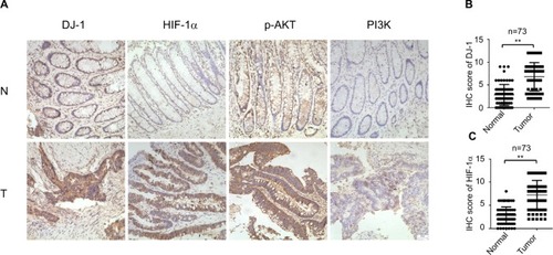 Figure 1 Expression of DJ-1, HIF-1, p-AKT, and PI3K in CRC and adjacent tissue.Notes: (A) Immunohistochemical staining of DJ-1, PI3K, p-AKT, and HIF-1α in CRC and adjacent normal tissues. First row, adjacent normal tissues (N); second row, tumor tissues (T). Images: 200× magnification. (B) DJ-1 IHC scores of tumors and adjacent normal tissues from 73 paired CRC specimens. (C) HIF-1α IHC scores of tumors and adjacent normal tissues from 73 paired CRC specimens. ** P < 0.01.Abbreviations: CRC, colorectal cancer; HIF-1α, hypoxia-inducible factor-1α; IHC, immunohistochemistry; p-AKT, phospho-Akt; PI3K, phosphatidylinositol 3-kinase.