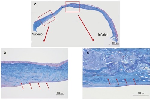 Figure 5 Masson’s trichrome staining of the excised cornea.