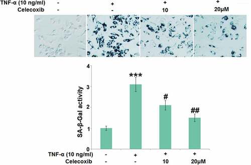 Figure 5. Celecoxib ameliorated cellular senescence against TNF-α in human C-28/I2 chondrocytes. Cells were treated with TNF-α (10 ng/ml) in the absence or presence of Celecoxib at concentrations of 10, 20 μM for 7 days. The SA-β-Gal activity was determined (***, P < 0.005 vs. vehicle group; #, ##, P < 0.05, 0.01 vs. TNF-α group)