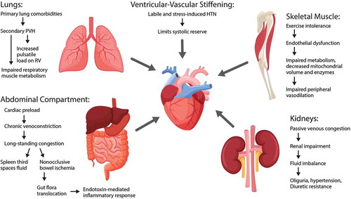 Figure 1. Schematic of the integrative pathophysiology of HFpEF and the involvement of different extracardiac mechanisms [Citation16,Citation17]. From top left, counterclockwise: lung involvement including primary lung disease leading to PAH, secondary PVH, impaired lung muscle mechanics, and eventual increased pulsatile RV load; abdominal compartment mechanisms including splanchnic circulation (preload), bowel congestion leading to endotoxin translocation and systemic inflammation; skeletal muscle mechanisms including impaired metabolism and peripheral vasodilation; renal mechanisms including passive congestion leading to renal impairment, changes in neurohormonal axis activation, hypertension, abnormal fluid homeostasis, eventual oliguria/renal insufficiency; ventricular-vascular mechanisms including ventricular stiffening leading to systolic and diastolic impairment, diminished systolic reserve, increased cardiac energetic demands and fluid-pressure shift sensitivity. HTN: hypertension; PAH: pulmonary arterial hypertension; PVH: pulmonary venous hypertension; RV: right ventricular. Figure reproduced from Sharma K, Kass DA. Heart failure with preserved ejection fraction: mechanisms, clinical features, and therapies. Circulation Research. 2014;115(1):79–96 [Citation16]. https://www.ahajournals.org/journal/res, with permission from Wolters Kluwer Health