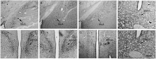Figure 3. ERα immunopositive staining in female mandarin voles. Sham-S, Sham-C and OVX-S (A, B and C); Sham-C and OVX-C (D and H); Sham-C, OVX-S and OVX-C (E, F and G). MeA, medial amygdale; BNST, bed nucleus of stria terminalis; MPOA, medial preoptic area; Sham-S and Sham-C: sham-ovariectomized females injected with saline and cocaine, respectively; OVX-S and OVX-C: ovariectomized females injected with saline and cocaine, respectively. Scale bar: 200 µm.