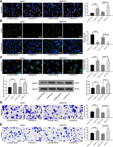 Figure 4 Inhibition of miR-624 restores HCC cell malignant behaviors induced by ZFAS1 silencing. (A) EdU staining of proliferating cells. (B) TUNEL staining of apoptotic cells. (C) Vimentin expression determined by immunofluorescence staining, RT-qPCR, and Western blot. (D) Migration ability determined by Transwell assays. (E) Invasion ability measured by Transwell assays. The data are expressed as the mean ± SD. One-way ANOVA and Tukey’s multiple comparison test were used to determine statistical significance. *p < 0.05 vs si-ZFAS1 + Mock treatment; **p < 0.01 vs si-ZFAS1 + Mock treatment.Abbreviations: ZFAS1, ZNFX1 antisense RNA 1; EdU, 5ʹ-ethynyl-2ʹ-deoxyuridine; DAPI, 4ʹ,6-diamidino-2-phenylindole; TUNEL, terminal deoxynucleotidyl transferase dUTP nick end labeling; In, inhibitor; GAPDH, glyceraldehyde-3-phosphate dehydrogenase; siRNA, small interfering RNA; HCC, hepatocellular carcinoma; miR, microRNA; RT-qPCR, reverse transcription-quantitative polymerase chain reaction; SD, standard deviation; ANOVA, analysis of variance.