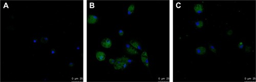 Figure 3 Confocal analyses of SR-A in AMs of COPD patients.