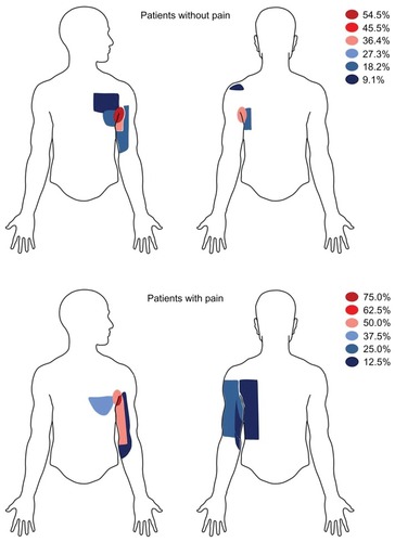 Figure 1 Area of tactile hypoesthesia (numbness).