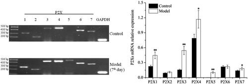 Figure 3. Analysis of P2X receptor subtypes expression in hind limb's articular cavities of model group. *P < 0.05, **P < 0.01, versus control.