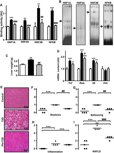 Figure 4 Phlorizin treatment ameliorates type 2 diabetes-induced NAFLD. Liver samples from control (C, white bars, circles), type 2 diabetes (T2D, black bars, up triangles) and phlorizin-treated T2D (Phl-T2D, dashed bars, diamonds) mice were analyzed: (A and B) HNF1A, HNF4A, HNF3B and NFKB binding activity in the Slc2a2 gene promoter measured by electrophoretic mobility shift assay (EMSA). In (B), for each transcription factor, the sequence of the lanes corresponds to the sequence of the results shown in the graphs; the arrows indicate the target protein/DNA complex. (C), liver weight; (D) mRNA expression of inflammatory markers (Tnf, Rela, Il6 and Il1b); (E) hematoxylin-eosin stained liver tissue (20X magnification); (F–H) steatosis, ballooning and inflammation grade; (I) NAFLD score. Data are expressed as mean ± SEM of 4 to 7 (A and D) or 5 to 9 (C) animals. In (F–I), data are the means and the individual values of 4 or 5 animals. The means were compared by Kruskal–Wallis, followed by the Dun post-test (HNF4A EMSA and Tnf mRNA) or one-way ANOVA, followed by the Newman-Keuls post-test (other results). *P<0.05, **P<0.01 and ***P<0.001 vs C; #P<0.05, ##P<0.01 and ###P<0.001 vs T2D.