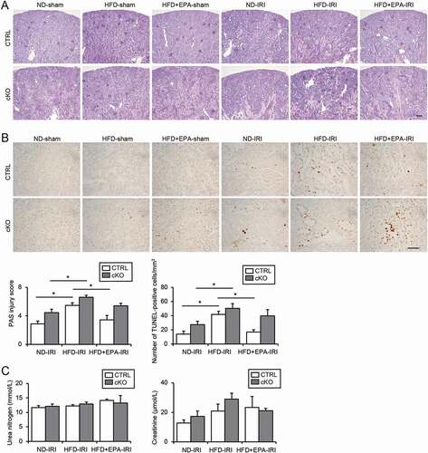 Figure 7. EPA improves the HFD-induced vulnerability toward an IRI in obese mice. (A, B) Images of PAS- (A) and TUNEL- (B) staining on kidney cortexes of the nonobese, obese, and EPA-supplemented obese Atg5 F/F-CTRL and atg5-cKO mice 2 d after a unilateral IRI or sham operation (n = 5 to 11 in each group). (A) The tubular injury score was shown. (B) The number of TUNEL-positive PTECs was calculated in at least 10 high-power fields (× 400). Bars: 100 μm (A) and 50 μm (B). (C) The plasma urea nitrogen and creatinine were measured. Data are provided as means ± SE. Statistically significant differences (*P < 0.05) are indicated. All images are representative of multiple experiments. CTRL: Atg5 F/F-CTRL mice; cKO: atg5-cKO mice
