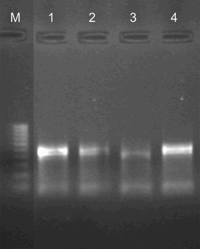 Figure 1. Detection of BRSV by the RT-PCR assay in nasal swabs.