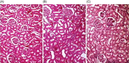 Figure 1. Representative histological photographs of kidney tissues from (A) control, (B) renal IRI, and (C) renal IRI + OT groups. Control group animals show normal histological characteristics of glomeruli and tubules. Rats subjected to renal IRI show marked necrosis with tubular dilation, swelling, luminal congestion, and medullar hemorrhage. Rats subjected to renal IRI injury and treated with OT show moderate kidney damage and moderate dilatation of the tubular structure.