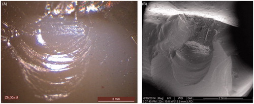 Figure 5. (A) Fracture surface of Y-TZP crown (nr 9) at 30 × magnification (light microscopy); (B) Fracture surface of Y-TZP crown (nr 9) at 45 × magnification (SEM).