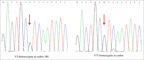 Figure 3. Graphic presentation of the sequencing analysis of PRNP. The left graph shows the DNA sequence of the patient at codon 180 shows a G to A heterozygous transition at codon 180 in one PRNP allele, leading to an exchange from Val (V) to Ile (I). The right graph shows a control of the DNA sequence of a person containing Val/Val homozygote at codon 180 in PRNP alleles.