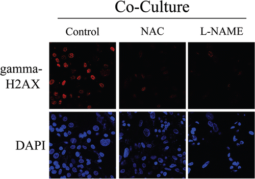 Figure 15 Rescue of DNA damage in fibroblast-MCF7 co-cultures with NAC and L-NAME. Treatment with NAC and L-NAME abolishes DNA double strand breaks in co-culture. Day2 co-cultures of hTERT-fibroblasts and MCF7 cells were treated with 10 mM NAC or with 20 mM L-NAME or with vehicle alone (H2O) for 72 hours. Then, cells were immunostained with anti-gamma-H2AX (red) antibodies. DAPI was used to stain nuclei (blue). Upper panels show only the red channel to appreciate gamma-H2AX staining, while the lower panels show nuclei staining. High levels of DNA double strand breaks are detected in co-cultured cells. Note that treatment with NAC and L-NAME abolishes DNA double strand breaks in co-cultured cells. Importantly, images were acquired using identical exposure settings. Original magnification, 40x.