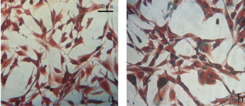 Figure 9 Prussian blue staining of iron in osteoblasts. Osteoblast SV40 incubated with chitosan-coated iron oxide nanoparticles (A) and uncoated iron oxide nanoparticles (B) at a concentration of 200 μg/mL for 24 hours.Note: Scale bar 50 μm.