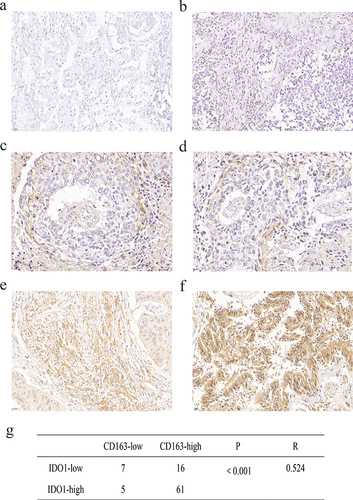 Figure 4 Association of IDO1 expression with M2 macrophages and the clinicopathological parameters of NSCLC patients. (a) Negative expression of CD163 in adjacent normal tissue. (b) Protein expression of IDO1 in the adjacent normal tissues shown in a. (c) Low expression of CD163 in NSCLC tissues. (d) Protein expression of IDO1 in the NSCLC tissues shown in c. (e) High expression of CD163 in NSCLC tissue. (f) Protein expression of IDO1 in the NSCLC tissues shown in e. (g) Correlation between IDO1 and CD163 protein expression in NSCLC (p<0.001, R=0.524).